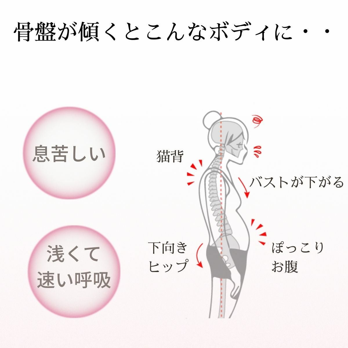 骨盤が傾くことでボディバランスが崩れた状態のイメージ