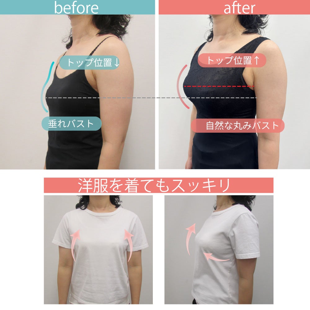 BFP05 PITALIFT 横向きビフォーアフター 垂れバストがトップ位置アップで自然な丸みバストに 洋服着用時もスッキリ